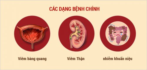 Dấu hiệu nguyên nhân và cách phòng tránh viêm đường tiết niệu