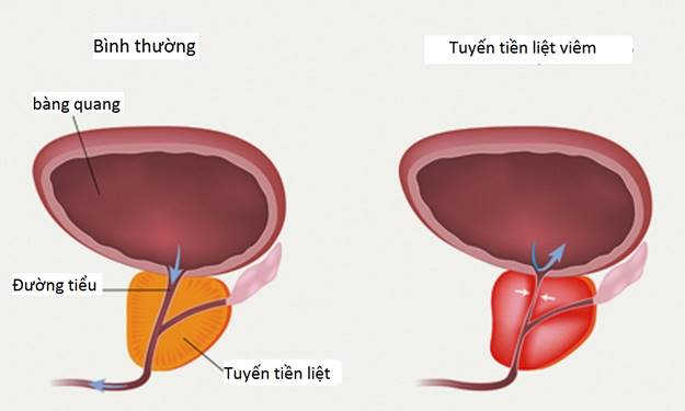 tiểu dắt