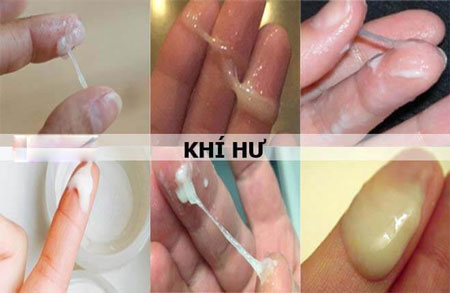 Nhận biết bệnh phụ khoa qua màu sắc khí hư
