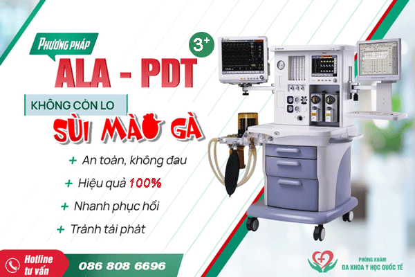 Điều trị sùi mào gà bằng ala-pdt-3
