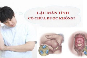 LẬU MÃN TÍNH CÓ CHỮA KHỎI KHÔNG? LỜI GIẢI ĐÁP SẼ CÓ NGAY DƯỚI ĐÂY!