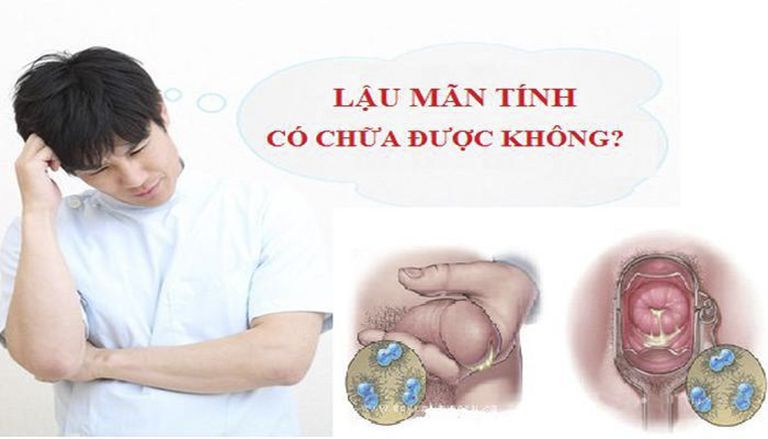 LẬU MÃN TÍNH CÓ CHỮA KHỎI KHÔNG?