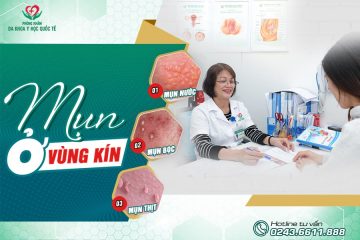 Vùng kín nổi mụn do đâu? Cách điều trị khi mắc bệnh
