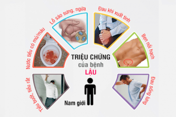 DẤU HIỆU CỦA BỆNH LẬU Ở NAM VÀ NỮ GIÚP PHÁT HIỆN BỆNH NGAY