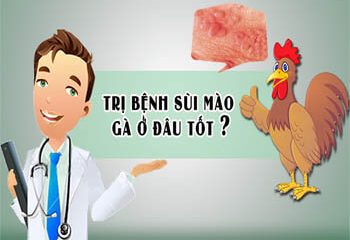 BÁC SĨ TƯ VẤN KHÁM CHỮA SÙI MÀO GÀ NHƯ THẾ NÀO?
