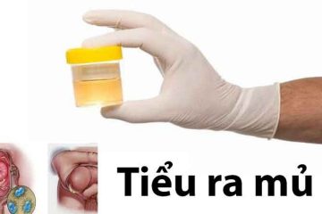 TIỂU RA MỦ LÀ DẤU HIỆU CỦA BỆNH GÌ?