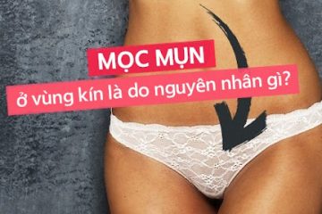 3 BỆNH LÝ ĐIỂN HÌNH GÂY NỔI MỤN VÙNG KÍN BẠN CẦN CẨN THẬN