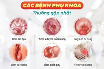 Đau rát sau khi quan hệ