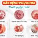 Đau rát sau khi quan hệ