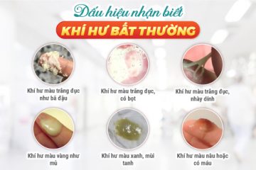 Dấu hiệu viêm phụ khoa qua màu sắc tính chất của khí hư