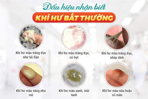 nhung-dieu-can-biet-ve-trieu-chung-khi-hu-bat-thuong-o-nu-gioi