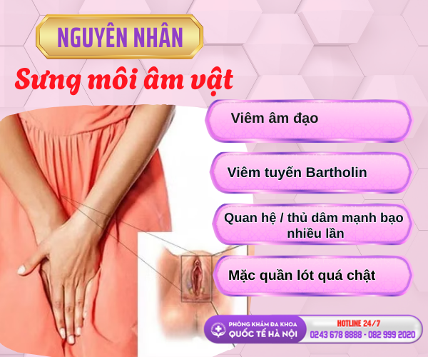 sung-moi-am-vat-trieu-chung-nho-he-luy-lon-neu-chu-quan