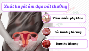 khi-hu-ra-nhieu-xuat-huyet-am-dao-bat-thuong