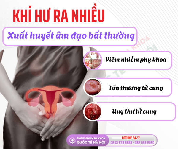 khi-hu-ra-nhieu-xuat-huyet-am-dao-bat-thuong